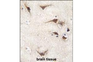 Formalin-fixed and paraffin-embedded human brain tissue reacted with SARS antibody (C-term) (ABIN392296 and ABIN2841952) , which was peroxidase-conjugated to the secondary antibody, followed by DAB staining. (Seryl-tRNA Synthetase (SARS) (AA 394-422), (C-Term) antibody)