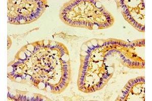 Immunohistochemistry of paraffin-embedded human small intestine tissue using ABIN7151376 at dilution of 1:100 (ENTPD5 antibody  (AA 149-428))