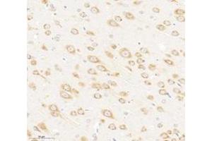 Immunohistochemistry analysis of paraffin-embedded rat brain using,VAMP4 (ABIN7076198) at dilution of 1: 3000 (VAMP4 antibody)