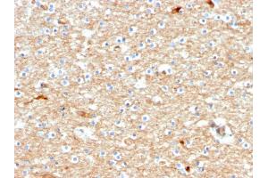 Formalin-fixed, paraffin-embedded human Brain stained with Drebrin-1 Mouse Monoclonal Antibody (DBN1/2880). (DBN1 antibody  (AA 150-281))