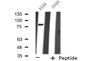 Western blot analysis of extracts from A549 cells, using ARHGEF16 antibody.