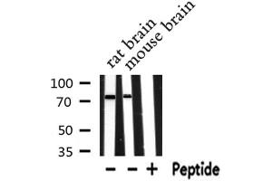 RAP1GAP antibody  (Internal Region)