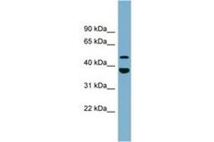 Image no. 1 for anti-Chromosome 4 Open Reading Frame 20 (C4orf20) (AA 395-444) antibody (ABIN6744146) (UFSP2 antibody  (AA 395-444))