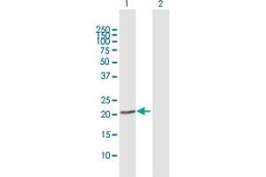Western Blot analysis of PMVK expression in transfected 293T cell line by PMVK MaxPab polyclonal antibody.