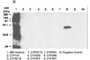A. (CYP3A5 antibody  (C-Term))