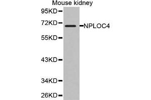 Western Blotting (WB) image for anti-Nuclear Protein Localization 4 Homolog (NPLOC4) (AA 1-270) antibody (ABIN1681086) (NPLOC4 antibody  (AA 1-270))