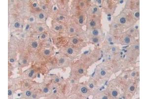 Detection of BACE2 in Human Liver Tissue using Polyclonal Antibody to Beta Secretase 2 (BACE2)