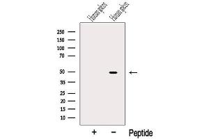 SERPINA5 antibody  (Internal Region)