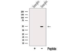 Western blot analysis of extracts from Human spleen tissue, using Serpin A5 Antibody.