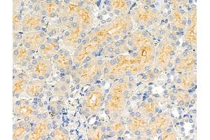 ABIN6258497 and ABIN6274436 at 1/100 staining Rat kidney tissue by IHC-P. (COQ8A antibody  (Internal Region))