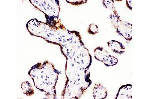 IHC-P: CYP11A1 antibody testing of human placenta tissue