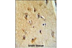 Immunohistochemistry (Paraffin-embedded Sections) (IHC (p)) image for anti-UDP-Gal:betaGlcNAc beta 1,4-Galactosyltransferase, Polypeptide 6 (B4GALT6) (AA 319-346), (C-Term) antibody (ABIN654654)