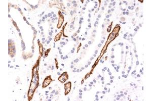 Formalin-fixed, paraffin-embedded human Kidney Transplant stained with Complement 4d Monoclonal Antibody (SPM545). (C4B antibody)