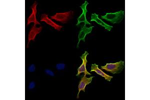 ABIN7094795 and ABIN7098846 staining Hela cells by IF/ICC.