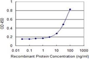 Detection limit for recombinant GST tagged ACSS2 is 1 ng/ml as a capture antibody. (ACSS2 antibody  (AA 32-130))