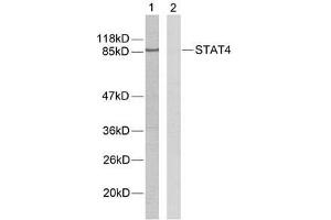 Western blot analysis of extracts from HeLa cells using STAT4 (Ab-693) antibody (E021047). (STAT4 antibody)