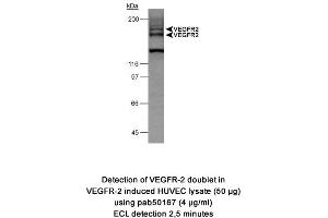 Image no. 1 for anti-VEGF Receptor 2 (VEGFR2) (AA 1200-1300), (Internal Region) antibody (ABIN363476) (VEGFR2/CD309 antibody  (Internal Region))