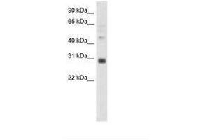 Image no. 1 for anti-Distal-Less Homeobox 5 (DLX5) (C-Term) antibody (ABIN202168) (DLX5 antibody  (C-Term))
