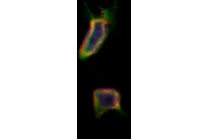ABIN6257957 and ABIN6275973 staining Hela by IF/ICC. (BAI1 antibody  (Internal Region))