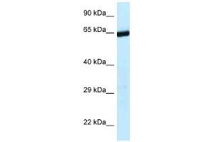Western Blotting (WB) image for anti-Excision Repair Cross-Complementing Rodent Repair Deficiency, Complementation Group 6-Like 2 (ERCC6L2) (C-Term) antibody (ABIN927636)