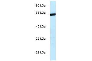 Western Blot showing 9330134C04Rik antibody used at a concentration of 1. (ERCC6L2 antibody  (C-Term))