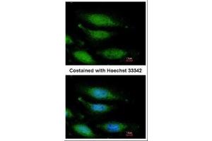 ICC/IF Image Immunofluorescence analysis of paraformaldehyde-fixed HeLa, using FANCG, antibody at 1:200 dilution. (FANCG antibody  (Center))