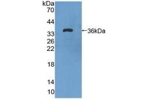 Detection of Recombinant VEGFR1, Rat using Polyclonal Antibody to Vascular Endothelial Growth Factor Receptor 1 (VEGFR1) (FLT1 antibody  (AA 18-308))