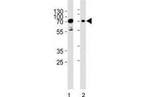 Western blot analysis of lysate from human 1) HeLa, and 2) Jurkat cell line using PAK3 antibody at 1:1000. (PAK3 antibody  (AA 124-152))