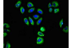 Immunofluorescent analysis of A549 cells using ABIN7153479 at dilution of 1:100 and Alexa Fluor 488-congugated AffiniPure Goat Anti-Rabbit IgG(H+L) (GABRA2 antibody  (AA 29-251))