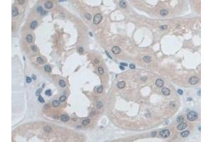 Detection of IDE in Human Kidney Tissue using Polyclonal Antibody to Insulin Degrading Enzyme (IDE) (IDE antibody  (AA 753-973))