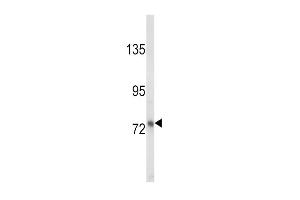 Western blot analysis of LTF Antibody (ABIN652643 and ABIN2842432) in MDA-M cell line lysates (35 μg/lane). (Lactoferrin antibody)