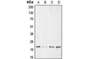 Western blot analysis of BNIP3 expression in HeLa (A), MCF7 (B), SHSY5Y (C), Ramos (D) whole cell lysates. (BNIP3 antibody  (Center))