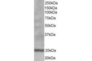Image no. 1 for anti-B-Cell CLL/lymphoma 2 (BCL2) (N-Term) antibody (ABIN374455) (Bcl-2 antibody  (N-Term))
