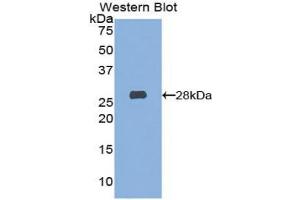 Detection of Recombinant HEXa, Mouse using Polyclonal Antibody to Hexosaminidase A Alpha (HEXa) (Hexosaminidase A antibody  (AA 319-528))