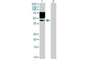 Western Blot analysis of CD96 expression in transfected 293T cell line by CD96 MaxPab polyclonal antibody.