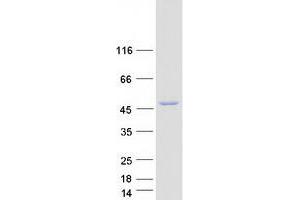Western Blotting (WB) image for Inositol-Tetrakisphosphate 1-Kinase (ITPK1) (Transcript Variant 2) protein (Myc-DYKDDDDK Tag) (ABIN2723915)