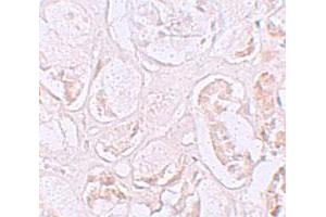 Immunohistochemical staining of human kidney cells with SLAMF9 polyclonal antibody  at 2.