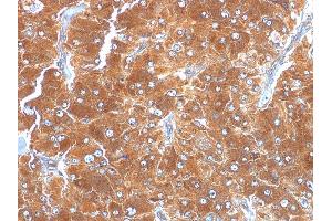 Formalin-fixed, paraffin-embedded human Adrenal stained with Adipophilin Mouse Monoclonal Antibody (ADFP/1494). (ADRP antibody  (AA 249-376))