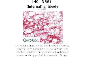 Image no. 1 for anti-Neuregulin 1 (NRG1) (Internal Region) antibody (ABIN5693648) (Neuregulin 1 antibody  (Internal Region))
