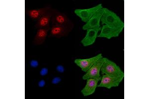 ABIN7093251 and ABIN7097268 staining H2O2 treated Hela cells by IF/ICC. (ETS1 antibody  (pThr38))