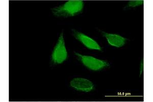 Immunofluorescence of monoclonal antibody to DIS3 on HeLa cell. (DIS3 antibody  (AA 861-956))