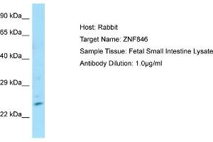 Host: Rabbit Target Name: ZNF846 Sample Type: Fetal Small Intestine lysates Antibody Dilution: 1. (ZNF846 antibody  (N-Term))
