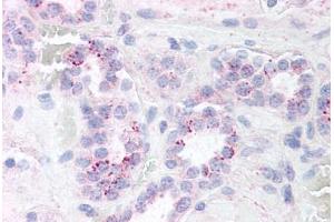 Human Kidney (formalin-fixed, paraffin-embedded) stained with RELA antibody ABIN214452 at 5 ug/ml followed by biotinylated goat anti-rabbit IgG secondary antibody ABIN481713, alkaline phosphatase-streptavidin and chromogen. (NF-kB p65 antibody)
