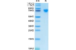 Cynomolgus GUCY2C on Tris-Bis PAGE under reduced condition. (GUCY2C Protein (AA 24-430) (His tag))