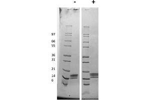 SDS-PAGE of Mouse Thrombopoietin Recombinant Protein SDS-PAGE of Mouse Thrombopoietin Recombinant Protein. (Thrombopoietin Protein (THPO))