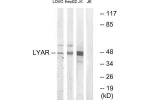 Western Blotting (WB) image for anti-Ly1 Antibody Reactive (LYAR) (Internal Region) antibody (ABIN1851050) (LYAR antibody  (Internal Region))