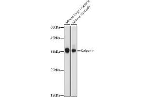 Western blot analysis of extracts of various cell lines, using Calponin antibody (ABIN7266040) at 1:1000 dilution. (CNN1 antibody  (AA 130-180))