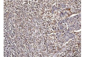 IHC analysis of ACADM/MCAD using anti-ACADM/MCAD antibody (ABIN7601543). (Medium-Chain Specific Acyl-CoA Dehydrogenase, Mitochondrial (MCAD) (AA 38-401) antibody)