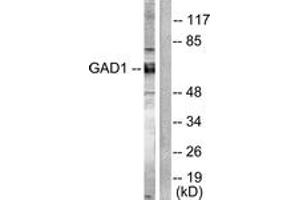 Western blot analysis of extracts from mouse brain cells, using GAD1/2 Antibody. (GAD65+GAD67 (AA 545-594) antibody)