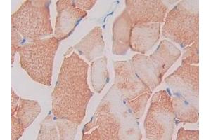 IHC-P analysis of Rat Skeletal muscle Tissue, with DAB staining.